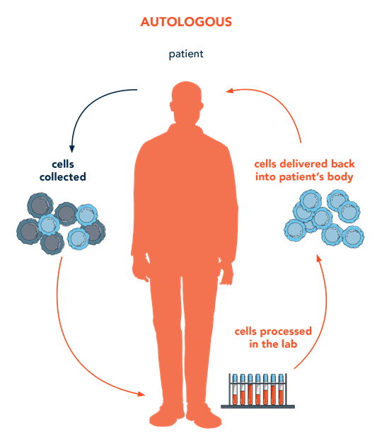 Image of autologous bone marrow transplant