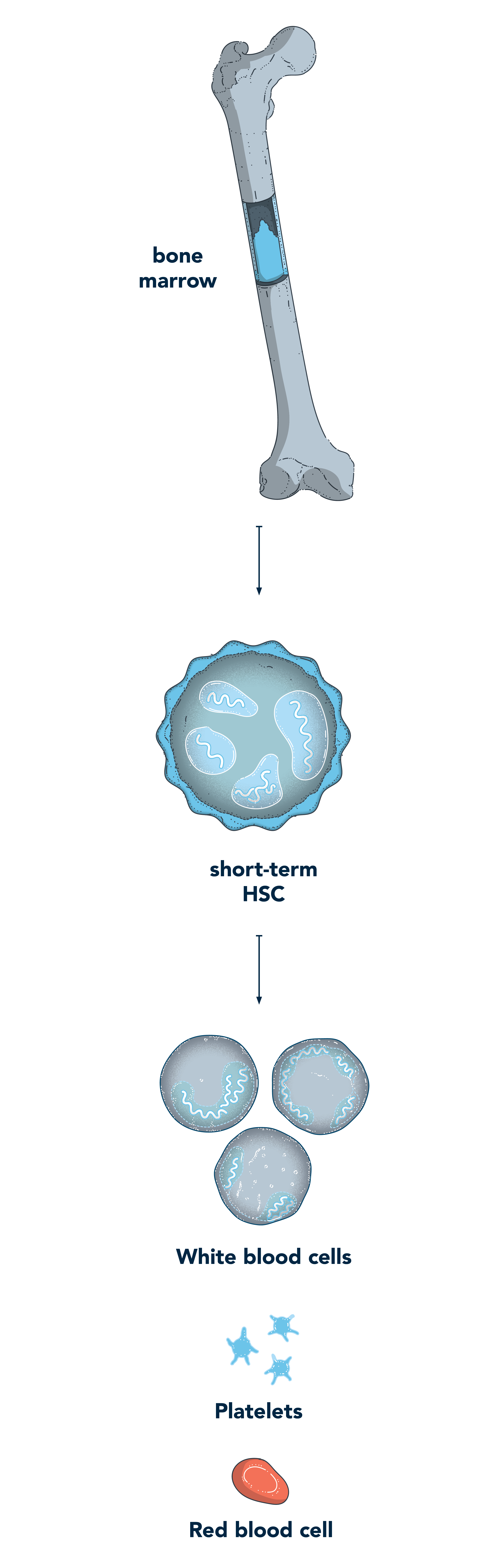 Example of bone marrow transplant for genetic diseases
