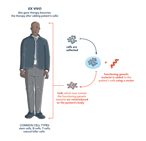 Image of ex vivo gene therapy