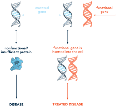 Image of gene addition gene therapy technique